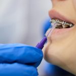 Close-up of dentist using interdental brush and cleaning dental braces of little girl at dental clinic.